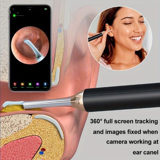 HD Visual Ear Cleaner Wireless Endoscope Ear Pick with Camera for Android & iPhone- multicolor